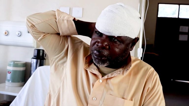 Vibaka Wamvamia Mwandishi Rashid Mkwinda wa Mbeya Yetu Ajeruhiwa Vibaya Kichwani na Kulazwa